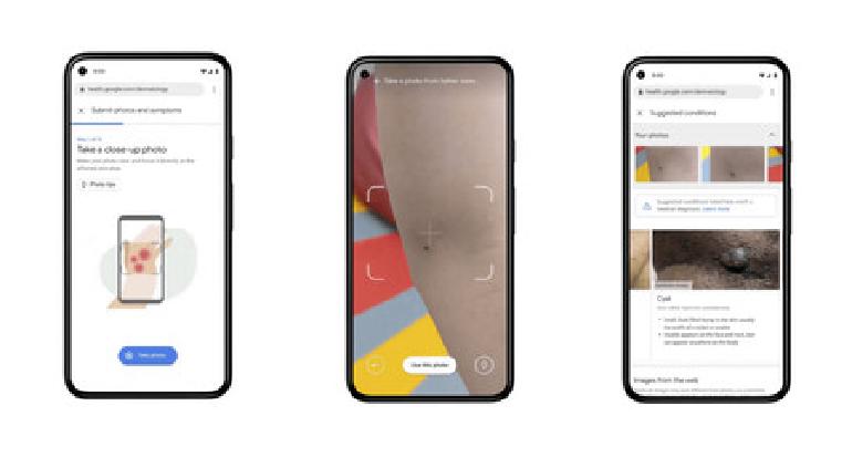 Identificará Google problemas en la piel usando la cámara del celular
